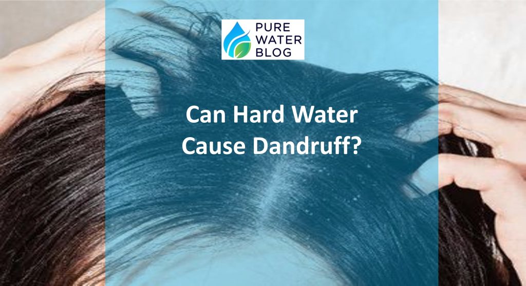 Can Hard Water Cause Dandruff? Water Treatment