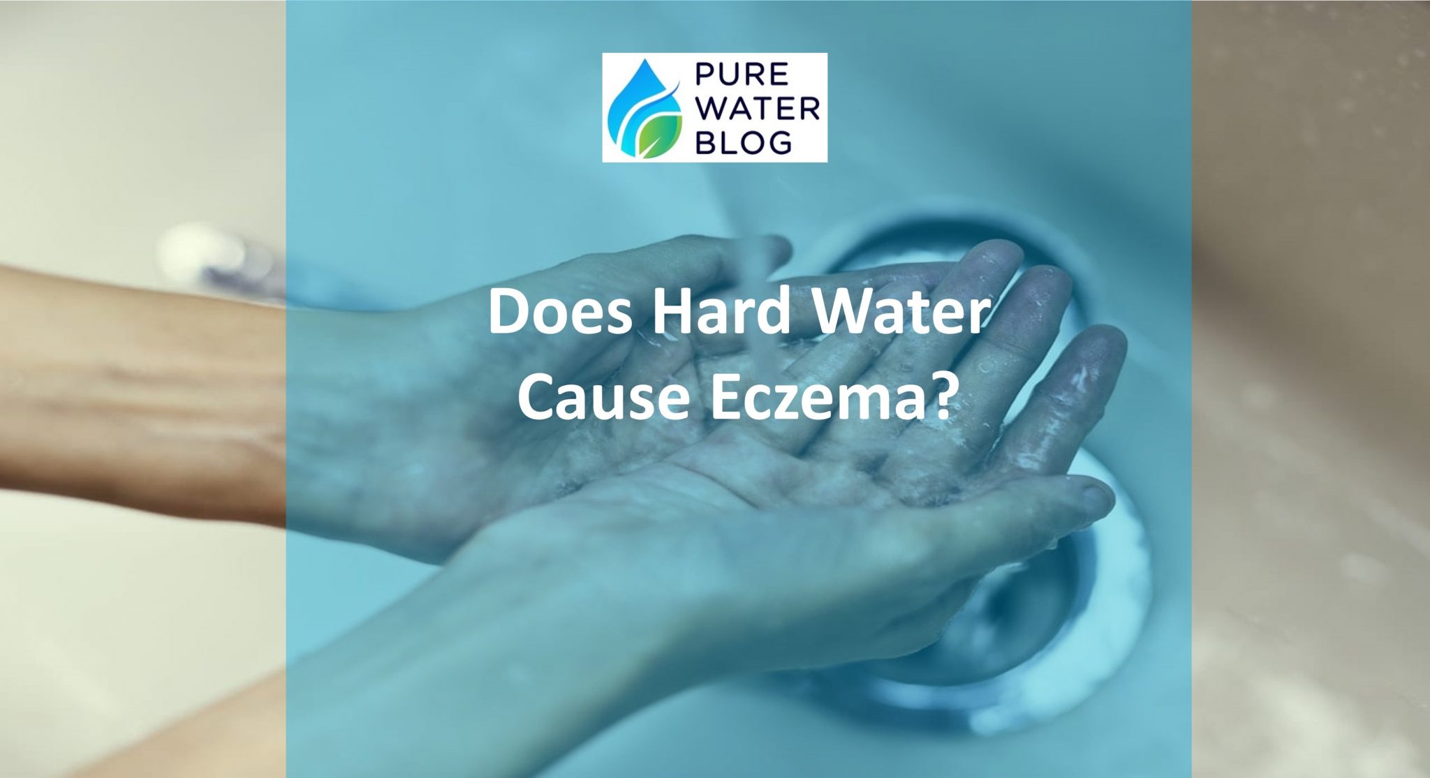 Hard Water Eczema What Causes It? Water Treatment