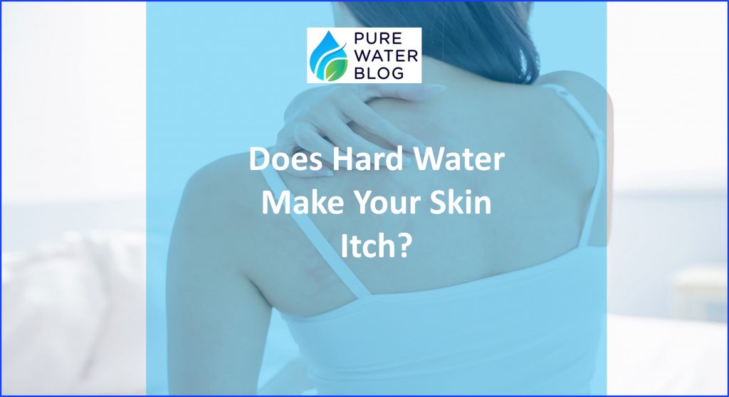 Does Hard Water Make Your Skin Itch? Water Treatment
